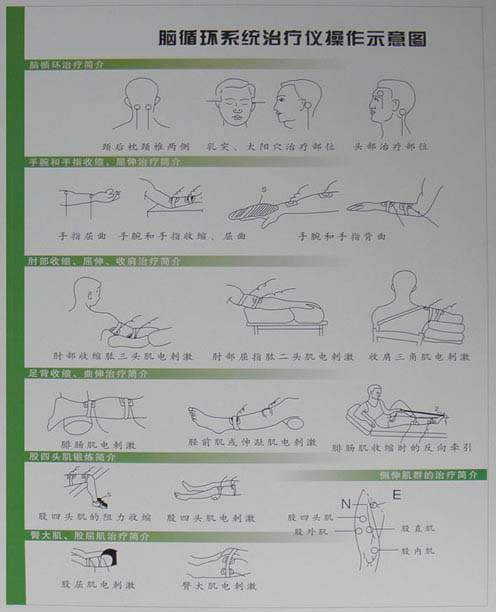 吸附式点刺激低频治疗仪针灸疗法